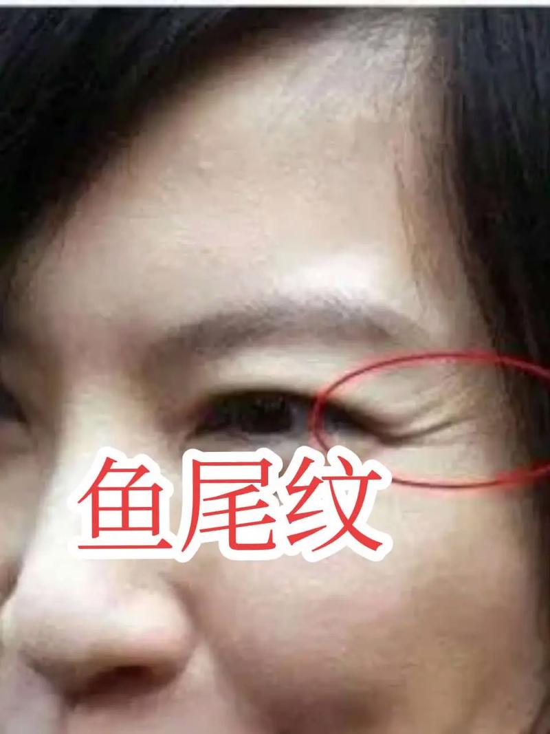 现代社会出轨频发,鱼尾纹竟能看出婚姻长短?(图2) 现代社会出轨频发,鱼尾纹竟能看出婚姻长短?(图2)