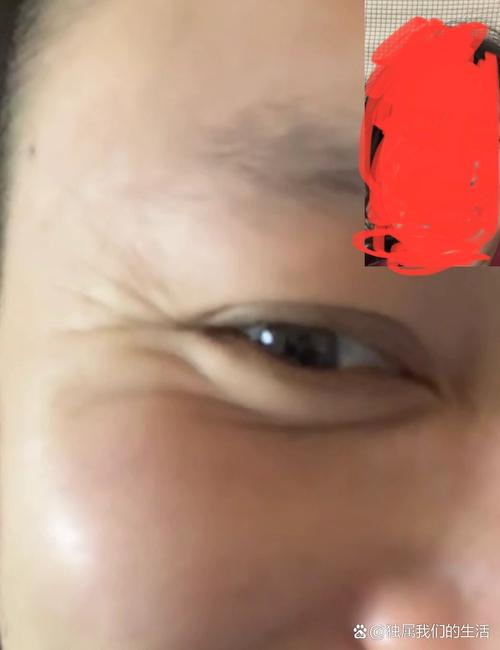 现代社会出轨频发,鱼尾纹竟能看出婚姻长短?(图3) 现代社会出轨频发,鱼尾纹竟能看出婚姻长短?(图3)