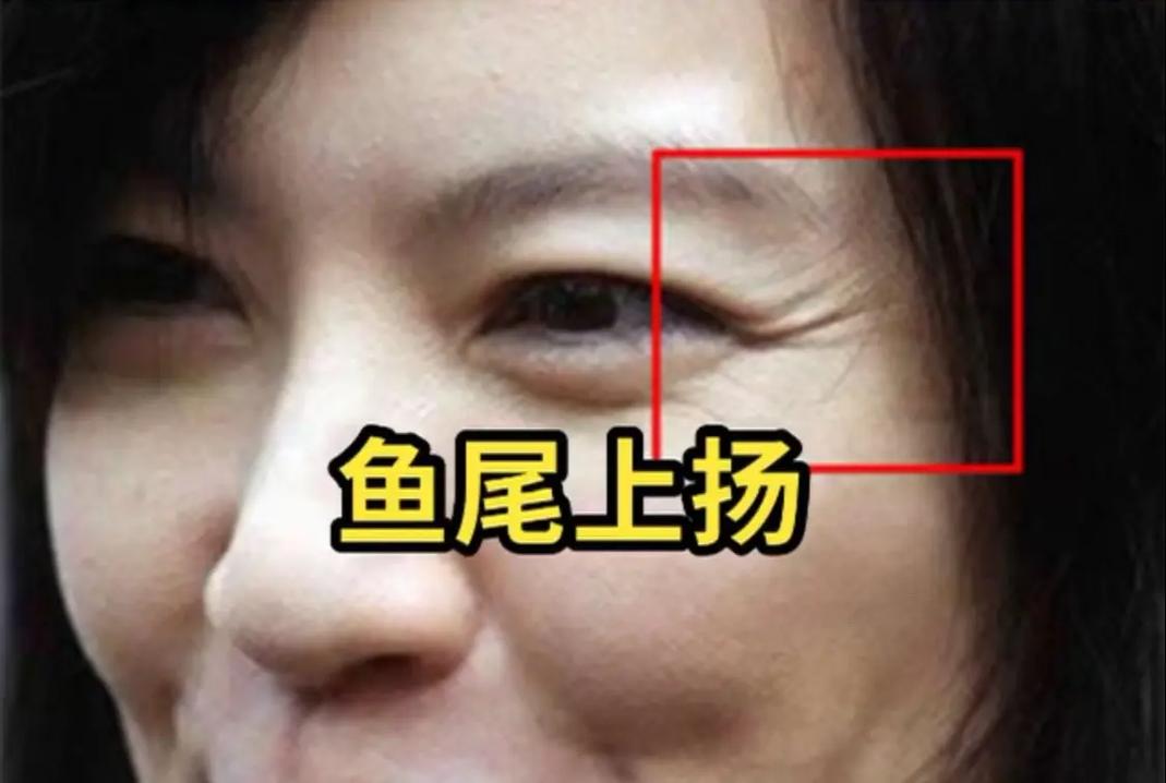 鱼尾纹出现意味着老了？其实它与性格及形成原因有关(图3)