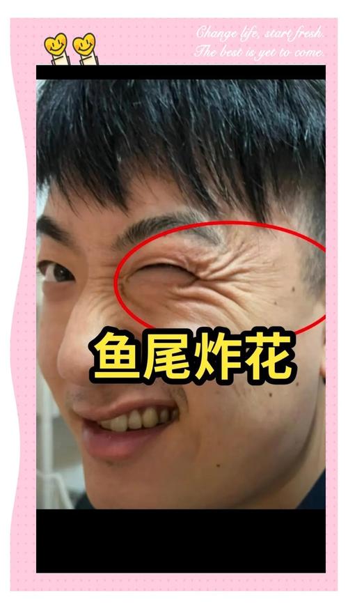 鱼尾纹形状各异,交叉分布的鱼尾纹对男人面相有何影响?(图2) 鱼尾纹形状各异,交叉分布的鱼尾纹对男人面相有何影响?(图2)