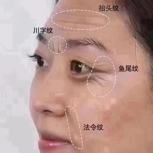 鱼尾纹形状各异,交叉分布的鱼尾纹对男人面相有何影响?(图3) 鱼尾纹形状各异,交叉分布的鱼尾纹对男人面相有何影响?(图3)